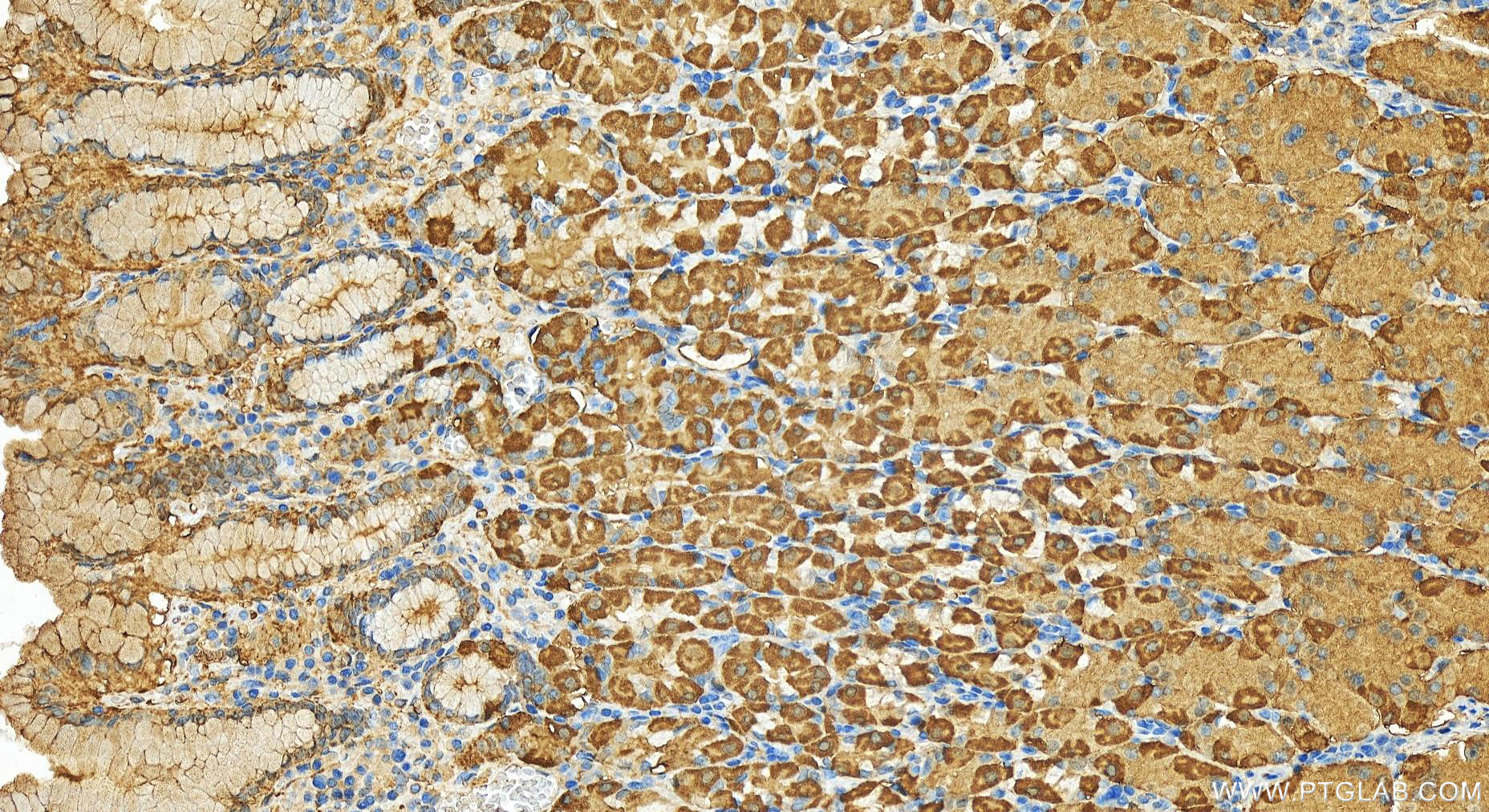 Immunohistochemical analysis of paraffin-embedded human stomach tissue slide using 13209-1-AP (AKR7A3 antibody) at dilution of 1:200 (under 20x lens). Heat mediated antigen retrieval with Tris-EDTA buffer (pH 9.0). Immunohistochemistry (IHC) staining of human stomach tissue using AKR7A3 Polyclonal antibody (13209-1-AP)