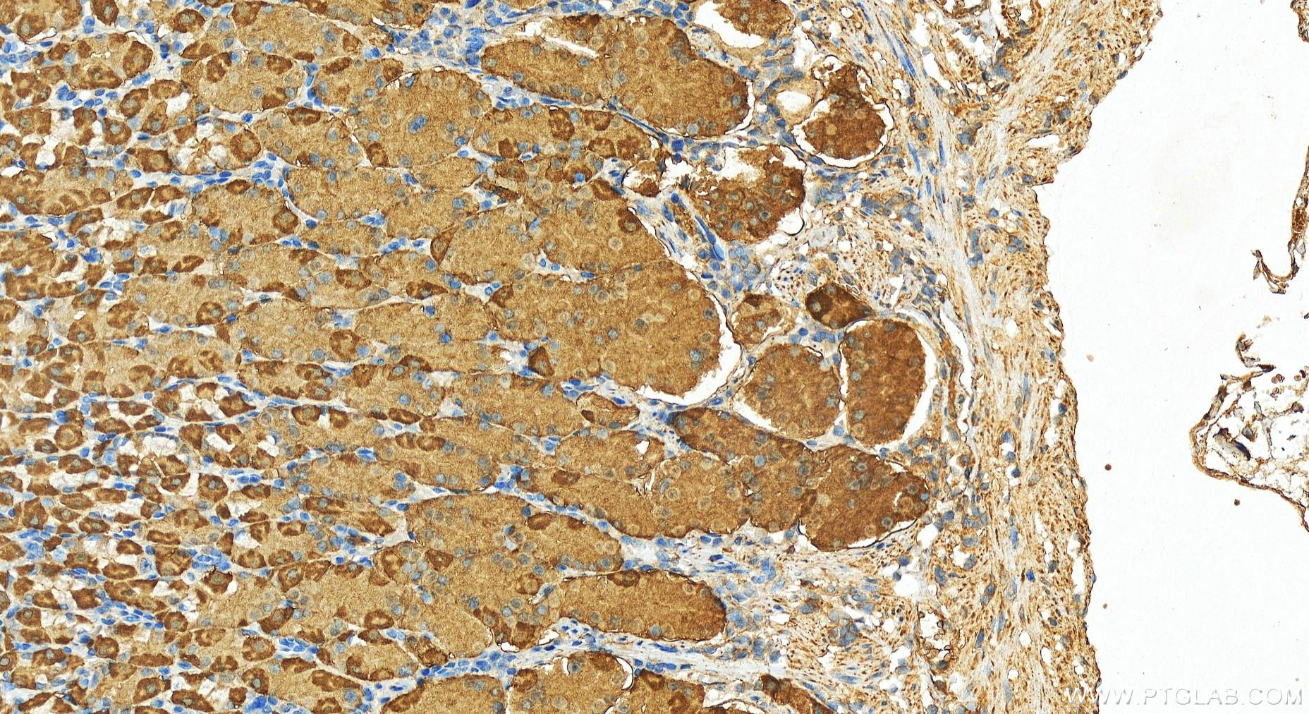 Immunohistochemical analysis of paraffin-embedded human stomach tissue slide using 13209-1-AP (AKR7A3 antibody) at dilution of 1:200 (under 20x lens). Heat mediated antigen retrieval with Tris-EDTA buffer (pH 9.0). Immunohistochemistry (IHC) staining of human stomach tissue using AKR7A3 Polyclonal antibody (13209-1-AP)