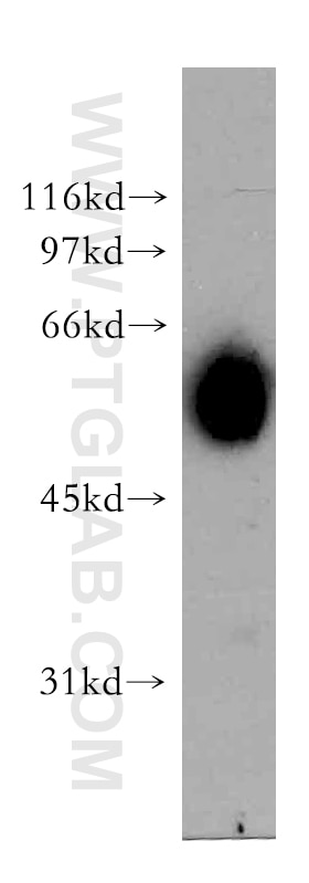Western Blot (WB) analysis of human brain tissue using AKR7A3 Polyclonal antibody (13209-1-AP)