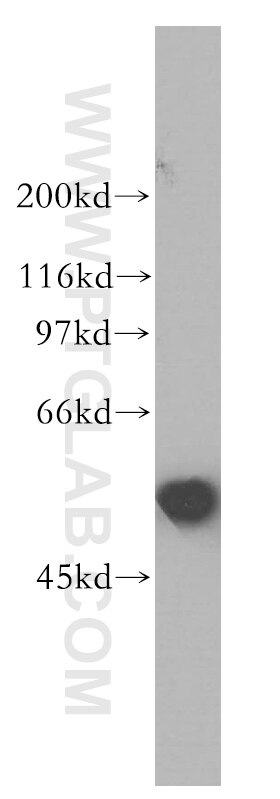 Western Blot (WB) analysis of HepG2 cells using AKR7A3 Polyclonal antibody (13209-1-AP)