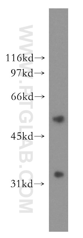 Western Blot (WB) analysis of human liver tissue using AKR7A3 Polyclonal antibody (13209-1-AP)
