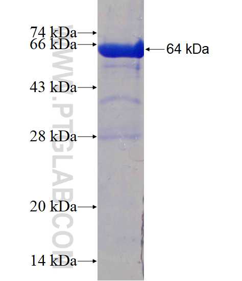 AKR7A3 fusion protein Ag3991 SDS-PAGE