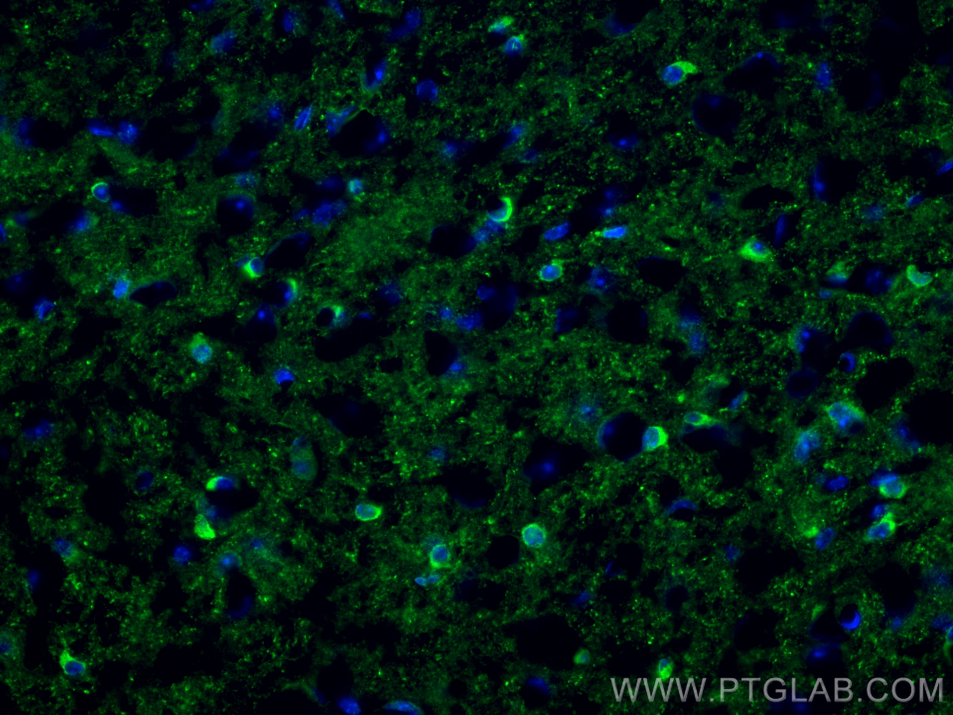 Immunofluorescence (IF) / fluorescent staining of mouse brain tissue using AKT Polyclonal antibody (10176-2-AP)