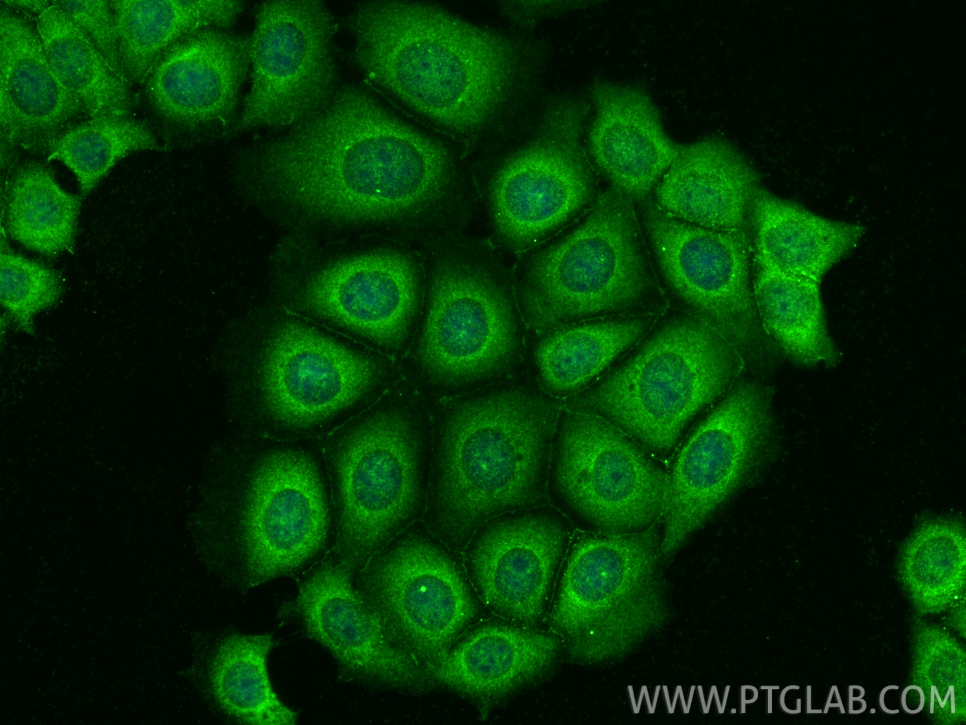 IF Staining of MCF-7 using 10176-2-AP Immunofluorescence (IF) / fluorescent staining of MCF-7 cells using AKT Polyclonal antibody (10176-2-AP)