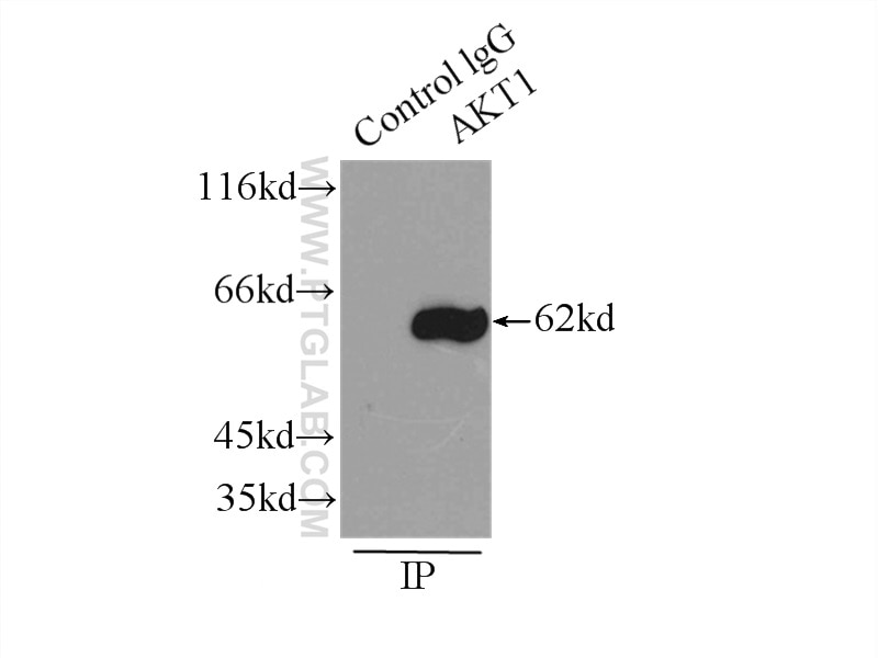 Immunoprecipitation (IP) experiment of HeLa cells using AKT Polyclonal antibody (10176-2-AP)