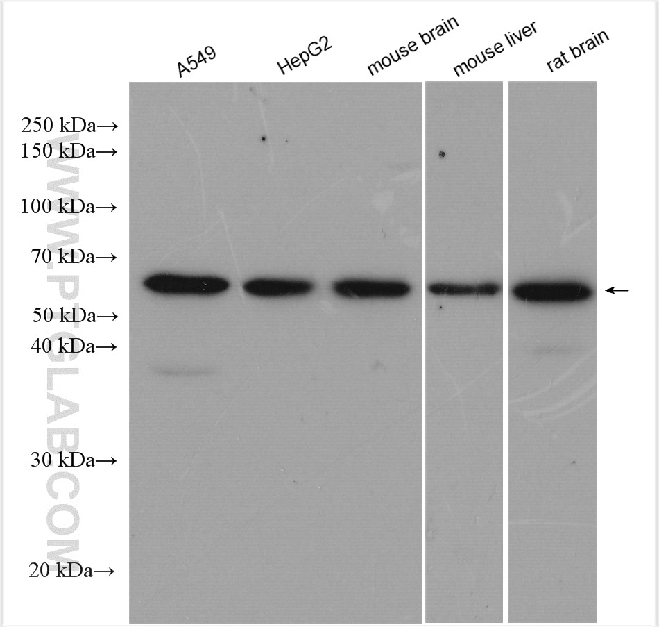 Western Blot (WB) analysis of various lysates using AKT Polyclonal antibody (10176-2-AP)