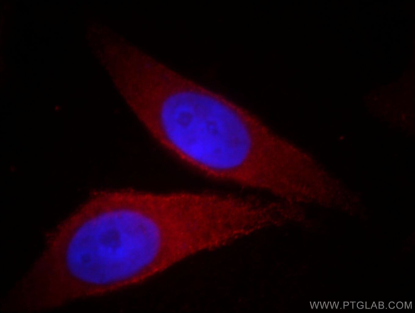 Immunofluorescence (IF) / fluorescent staining of MCF-7 cells using AKT1/3 Monoclonal antibody (60203-1-Ig)