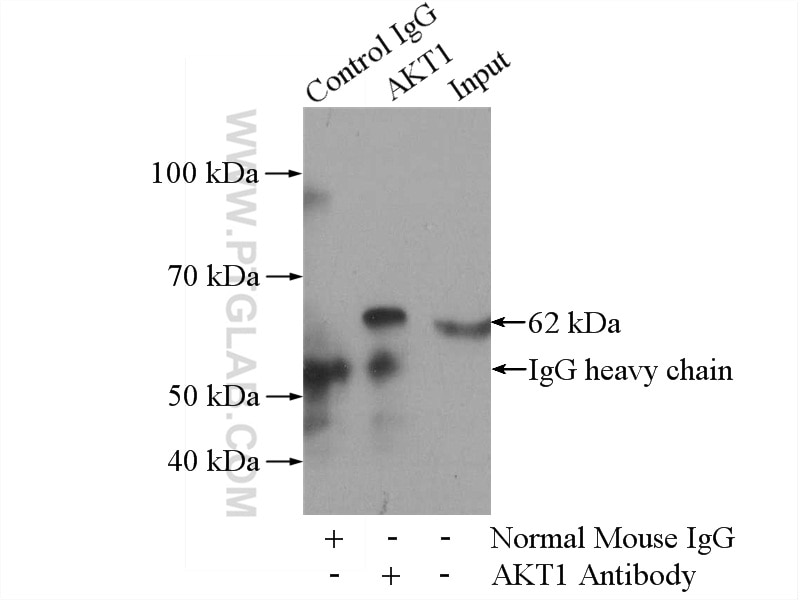 Immunoprecipitation (IP) experiment of mouse brain tissue using AKT1/3 Monoclonal antibody (60203-1-Ig)