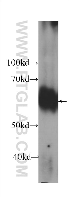 Western Blot (WB) analysis of rat liver tissue using AKT1/3 Monoclonal antibody (60203-1-Ig)