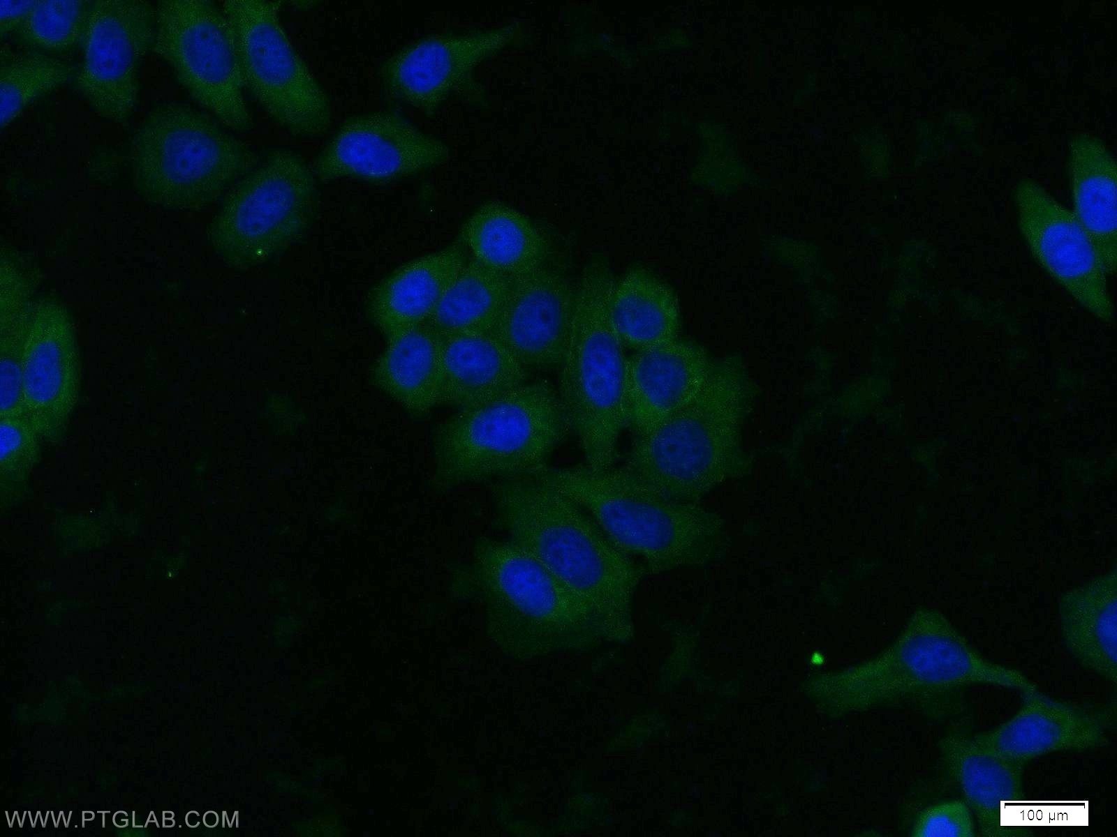 Immunofluorescence (IF) / fluorescent staining of HeLa cells using AKT Monoclonal antibody (60203-2-Ig)