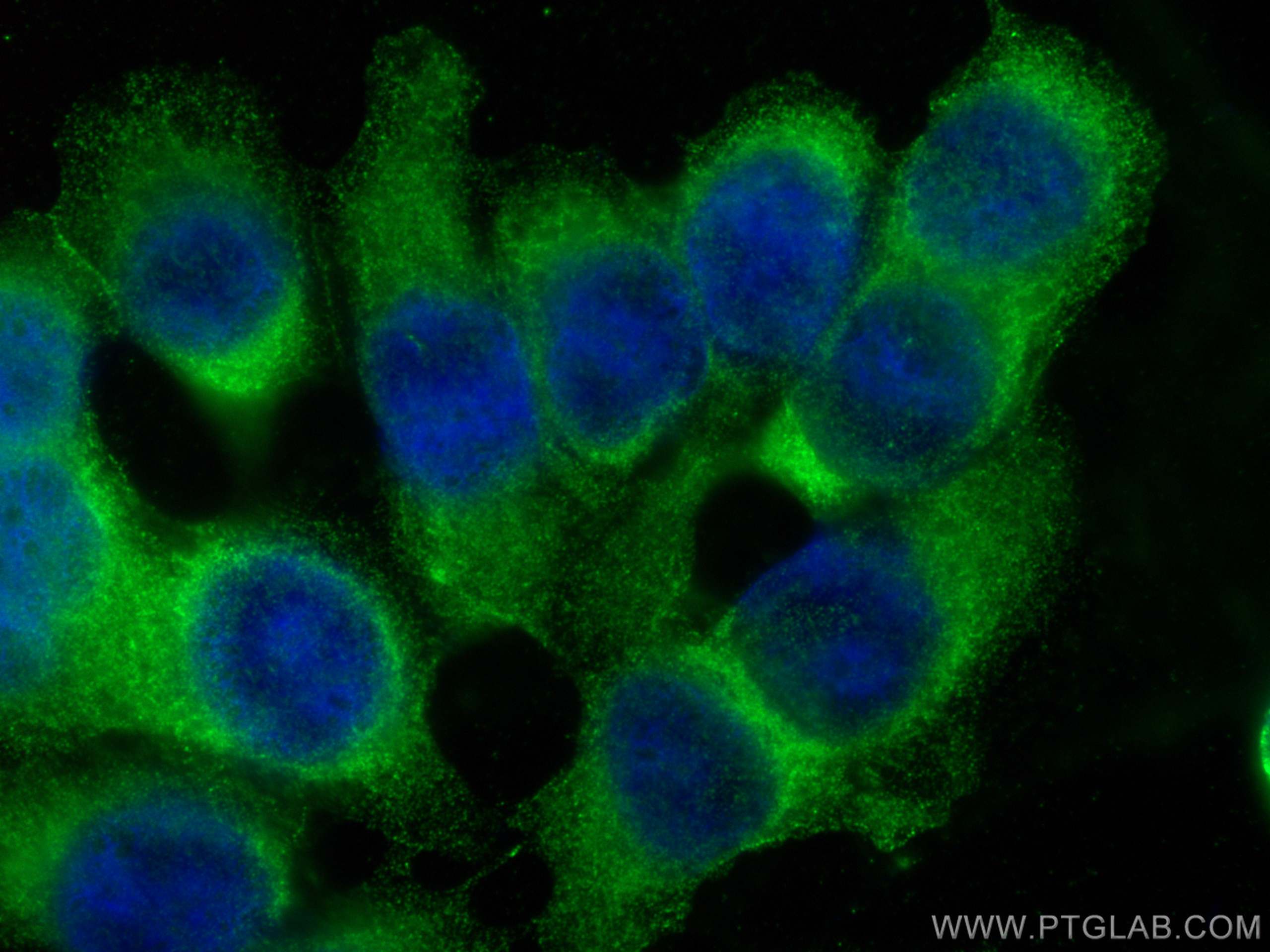 Immunofluorescence (IF) / fluorescent staining of MCF-7 cells using AKT Monoclonal antibody (60203-2-Ig)