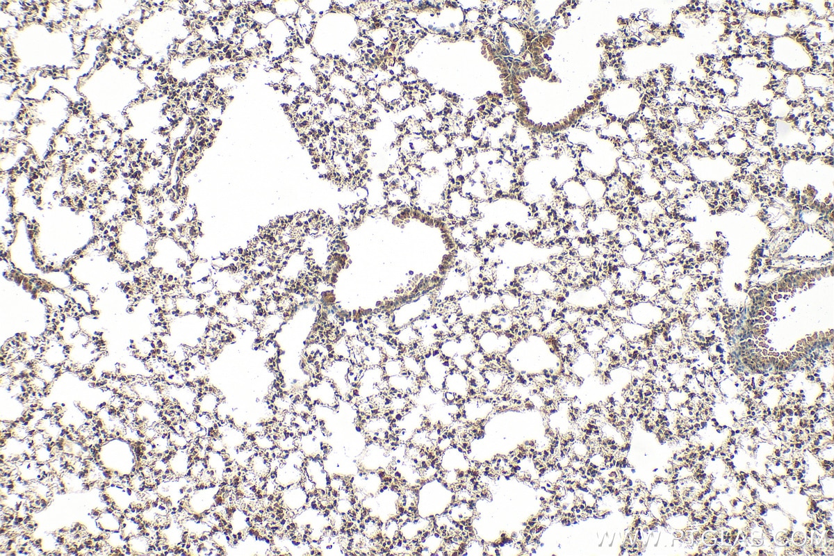 Immunohistochemical analysis of paraffin-embedded mouse lung tissue slide using 60203-2-Ig (AKT antibody) at dilution of 1:500 (under 10x lens). Heat mediated antigen retrieval with Tris-EDTA buffer (pH 9.0). Immunohistochemistry (IHC) staining of mouse lung tissue using AKT Monoclonal antibody (60203-2-Ig)
