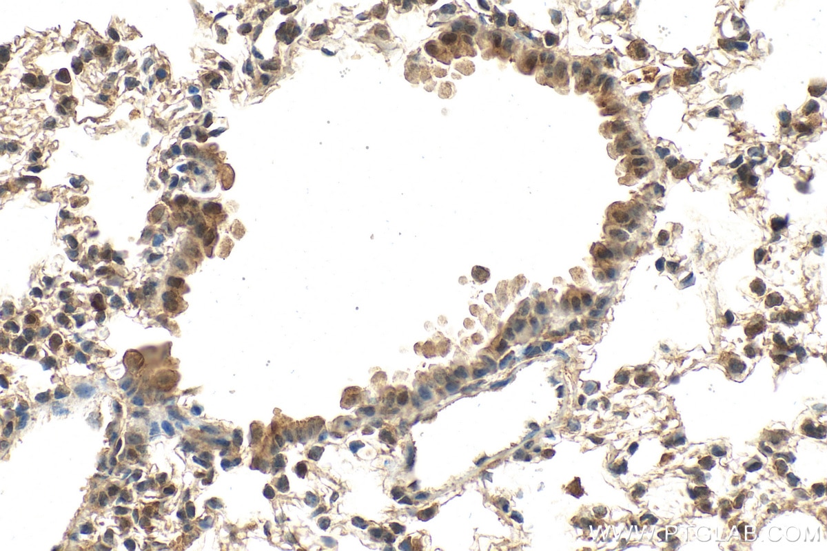 Immunohistochemical analysis of paraffin-embedded mouse lung tissue slide using 60203-2-Ig (AKT antibody) at dilution of 1:500 (under 40x lens). Heat mediated antigen retrieval with Tris-EDTA buffer (pH 9.0). Immunohistochemistry (IHC) staining of mouse lung tissue using AKT Monoclonal antibody (60203-2-Ig)