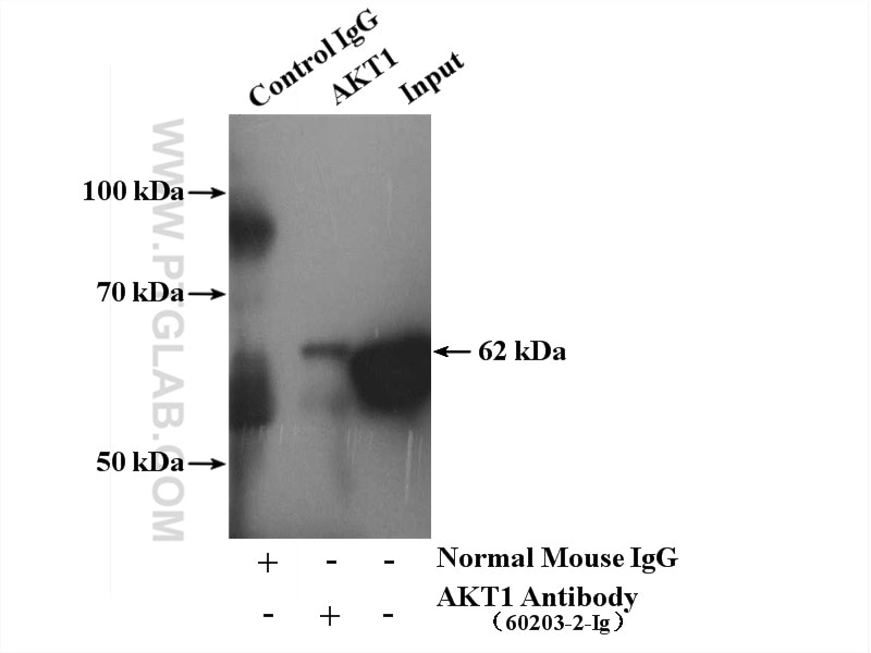 Immunoprecipitation (IP) experiment of mouse brain tissue using AKT Monoclonal antibody (60203-2-Ig)