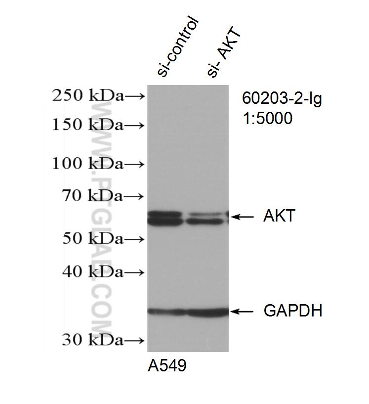 Western Blot (WB) analysis of A549 cells using AKT Monoclonal antibody (60203-2-Ig)