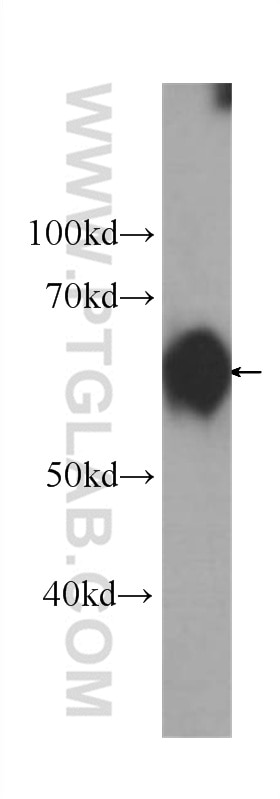 WB analysis of rat liver using 60203-2-Ig