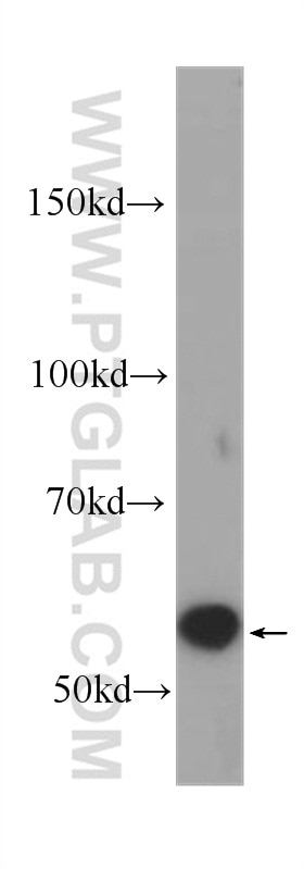 Western Blot (WB) analysis of mouse brain tissue using AKT Monoclonal antibody (60203-2-Ig)