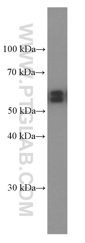 Western Blot (WB) analysis of HEK-293 cells using AKT Monoclonal antibody (60203-2-Ig)