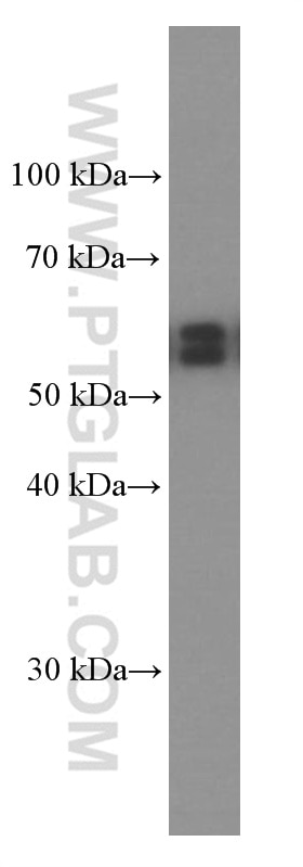 AKT Monoclonal antibody