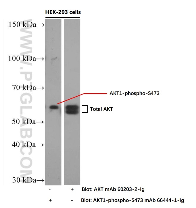 Western Blot (WB) analysis of HEK-293 cells using AKT Monoclonal antibody (60203-2-Ig)