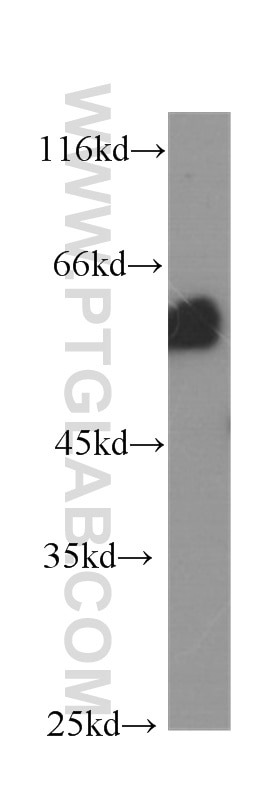 AKT Monoclonal antibody