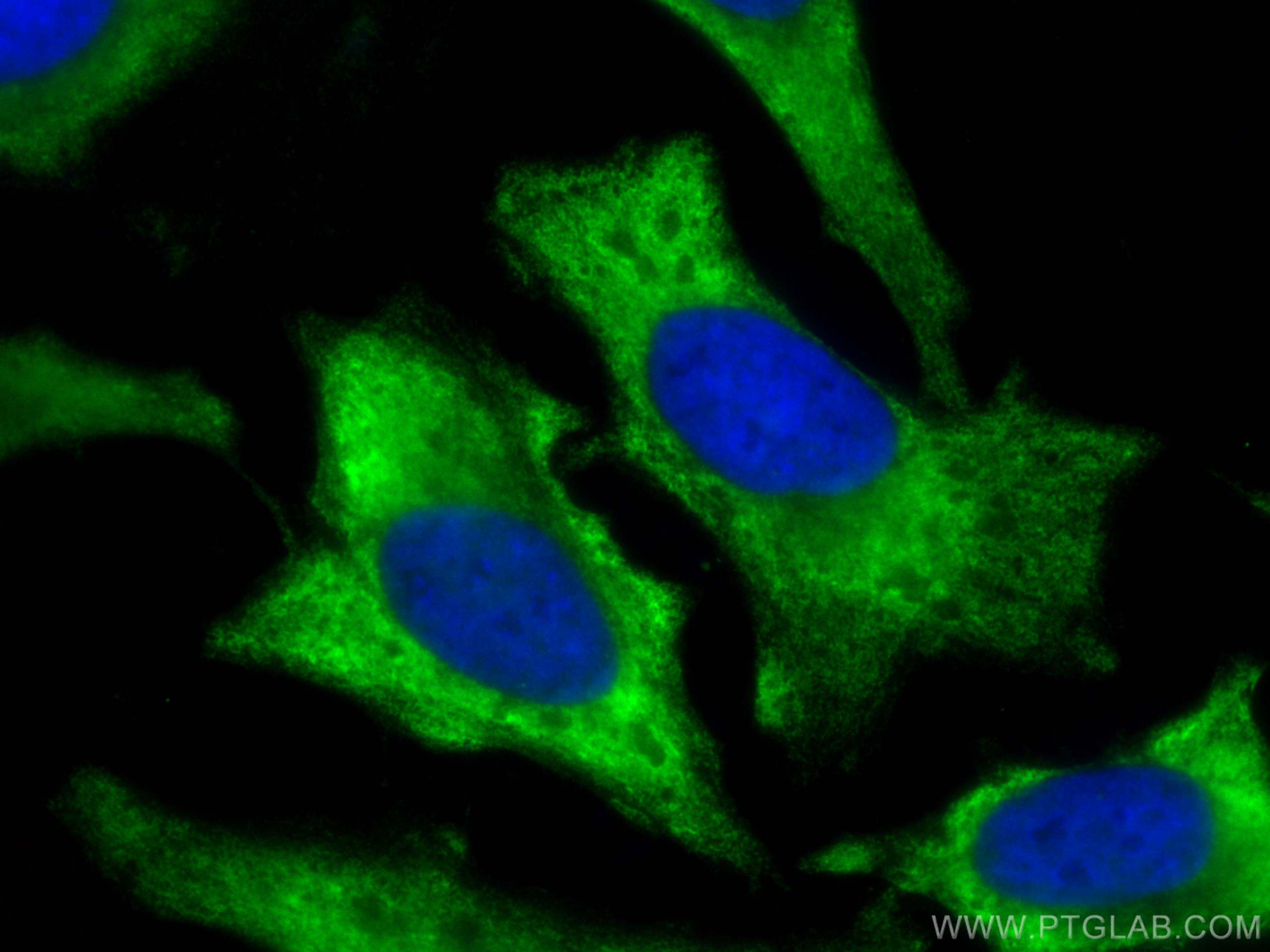 Immunofluorescence (IF) / fluorescent staining of HeLa cells using CoraLite® Plus 488-conjugated AKT Polyclonal antib (CL488-10176)