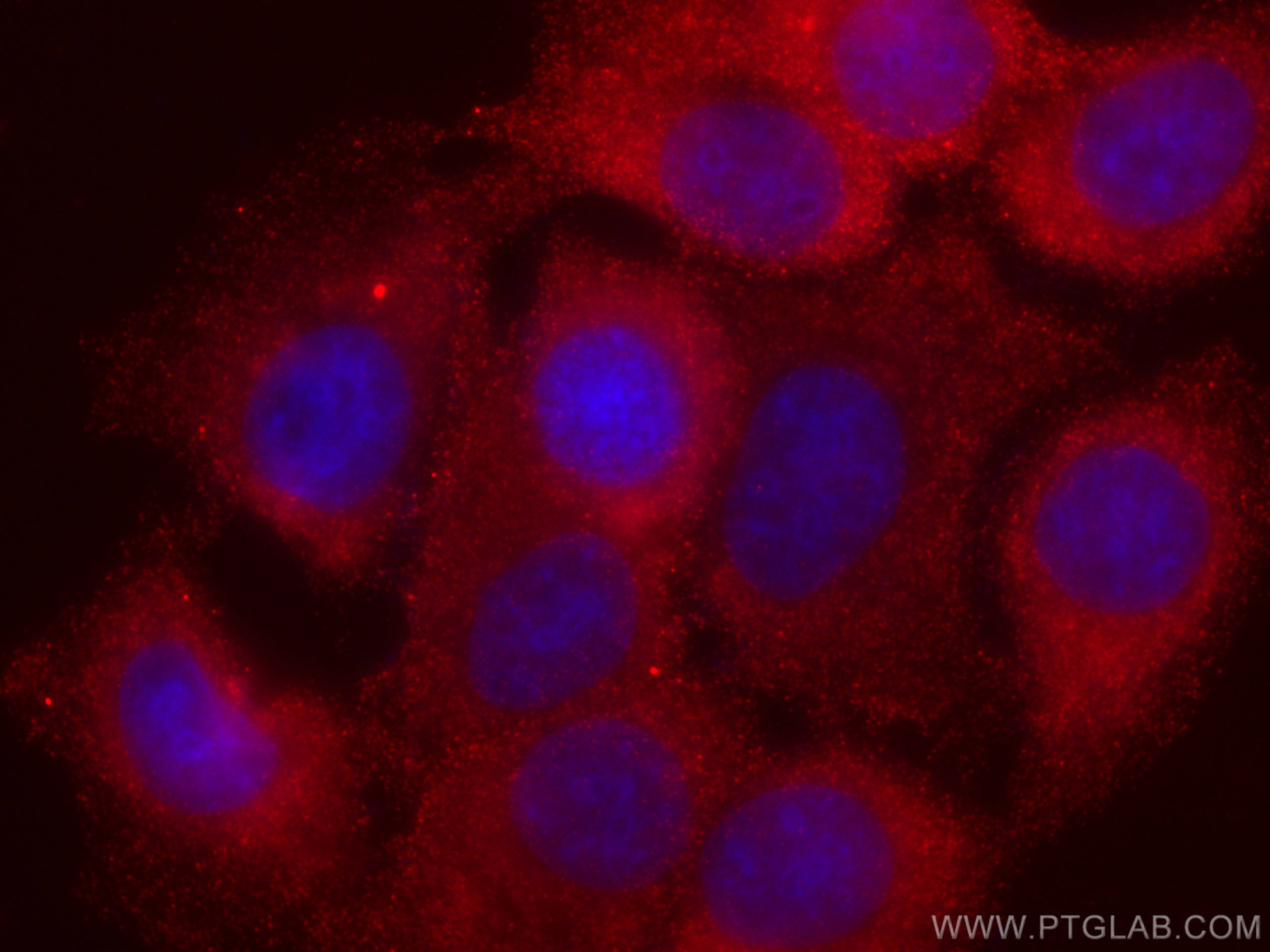 Immunofluorescence (IF) / fluorescent staining of MCF-7 cells using CoraLite®594-conjugated AKT Monoclonal antibody (CL594-60203)