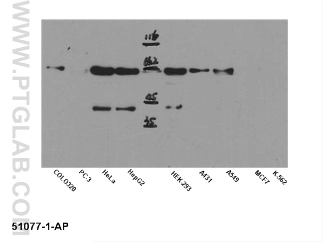 AKT Polyclonal antibody