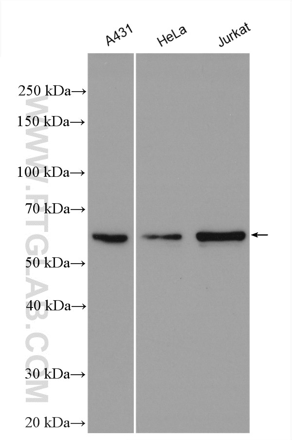 Western Blot (WB) analysis of various lysates using AKT Polyclonal antibody (51077-1-AP)