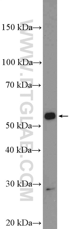 Western Blot (WB) analysis of A549 cells using AKT Polyclonal antibody (55230-1-AP)