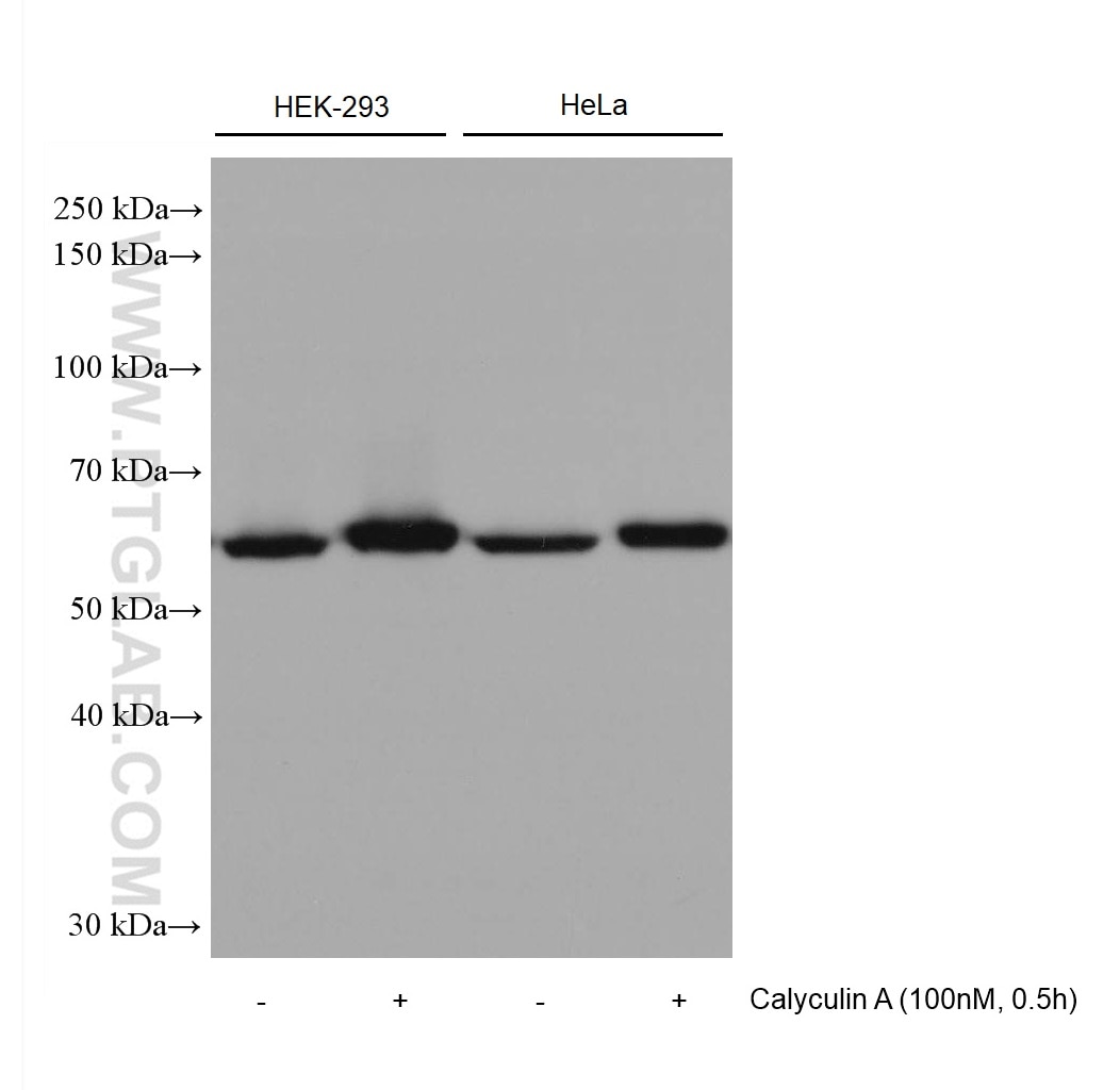 Western Blot (WB) analysis of various lysates using AKT1 (C-terminal) Recombinant antibody (80457-1-RR)