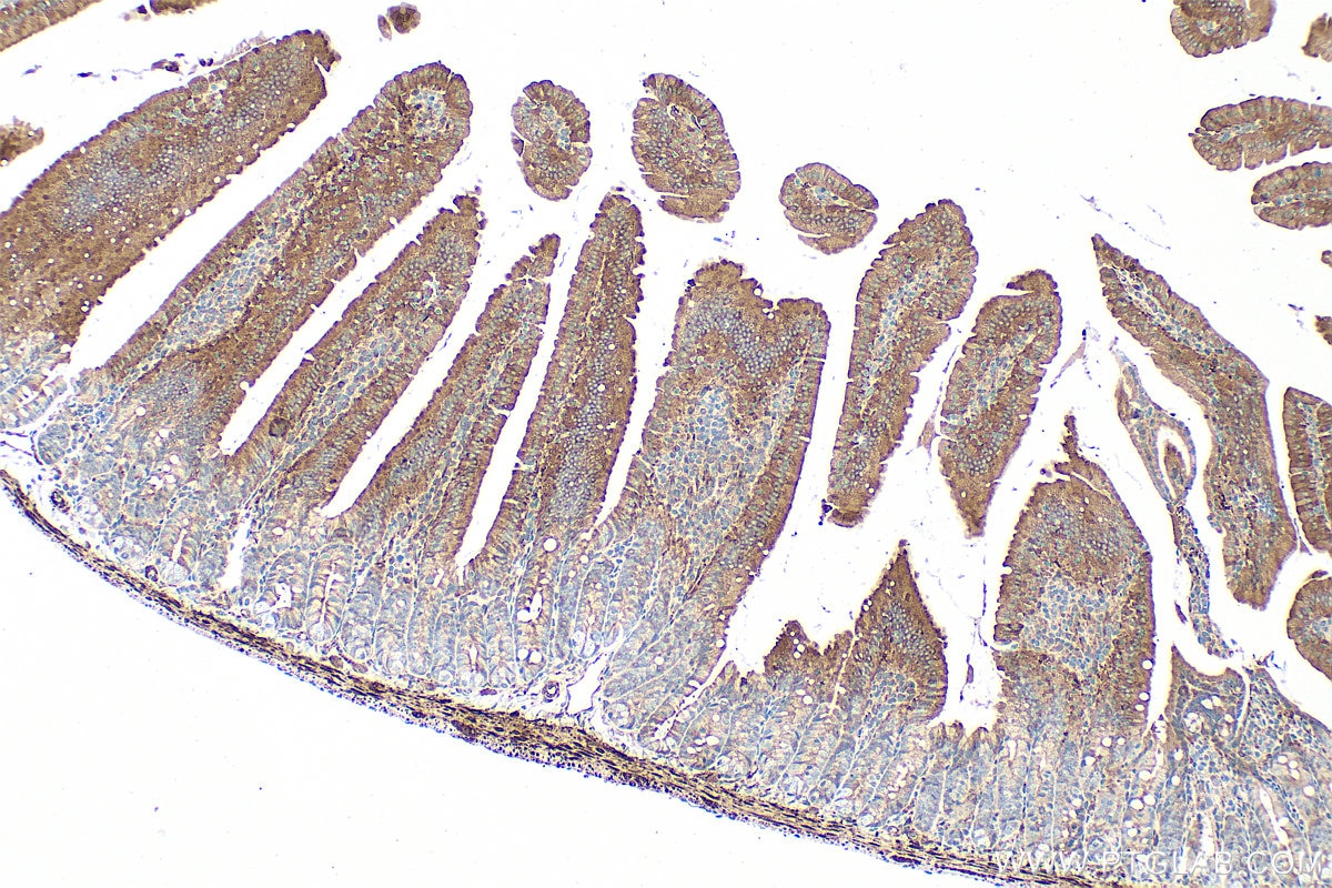 Immunohistochemical analysis of paraffin-embedded mouse small intestine tissue slide using 80816-1-RR (AKT1-Specific antibody) at dilution of 1:2000 (under 10x lens). Heat mediated antigen retrieval with Tris-EDTA buffer (pH 9.0). This data was developed using the same antibody clone with 80816-1-PBS in a different storage buffer formulation. Immunohistochemistry (IHC) staining of mouse small intestine tissue using AKT1-Specific Recombinant monoclonal antibody (80816-1-RR)