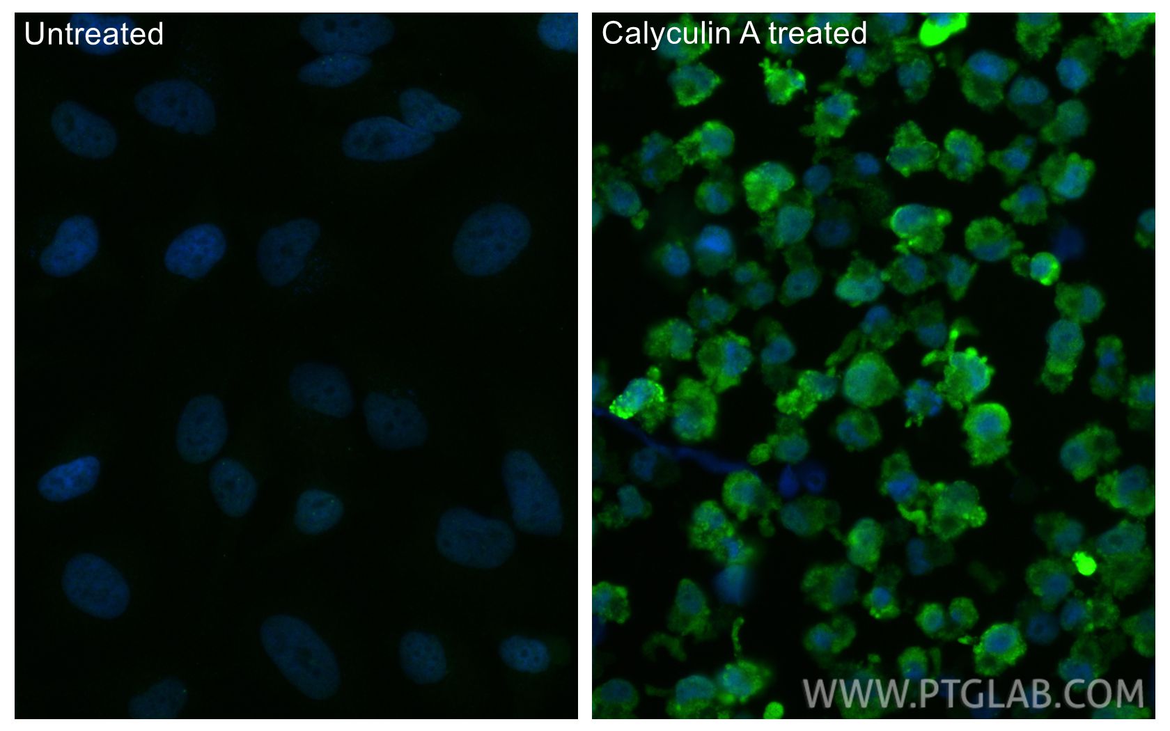 Immunofluorescence (IF) / fluorescent staining of HeLa cells using Phospho-AKT (Ser473) Polyclonal antibody (28731-1-AP)