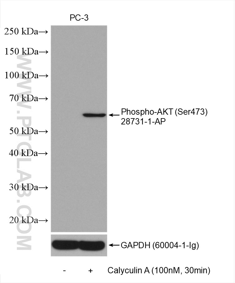 Western Blot (WB) analysis of various lysates using Phospho-AKT (Ser473) Polyclonal antibody (28731-1-AP)