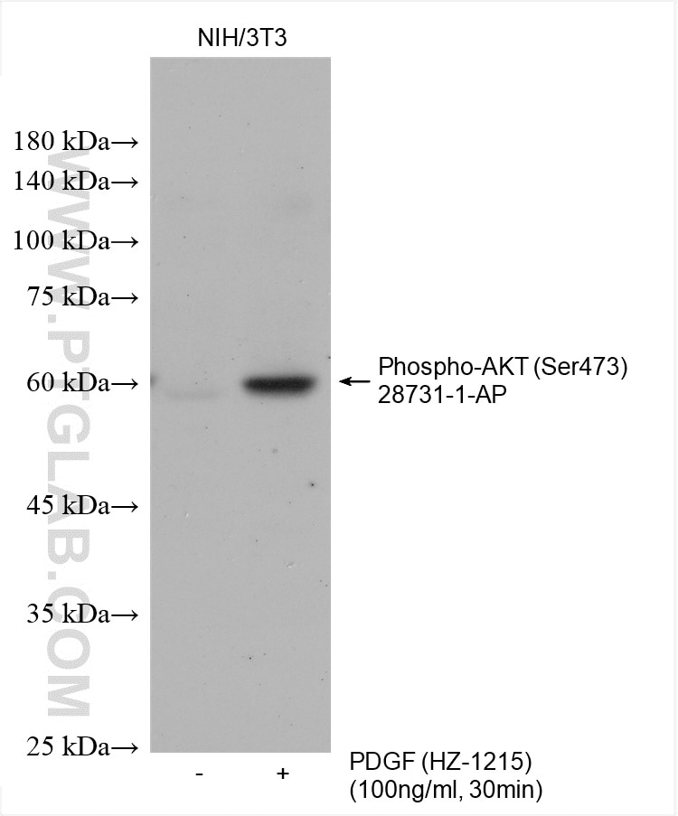 Western Blot (WB) analysis of various lysates using Phospho-AKT (Ser473) Polyclonal antibody (28731-1-AP)