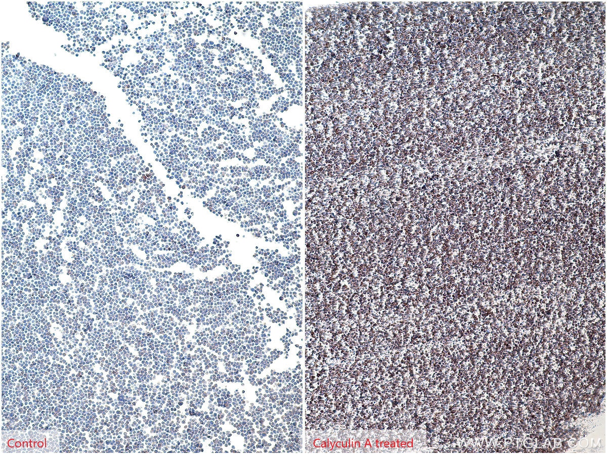 Immunohistochemistry (IHC) staining of Jurkat cells using Phospho-AKT (Ser473) Monoclonal antibody (66444-1-Ig)