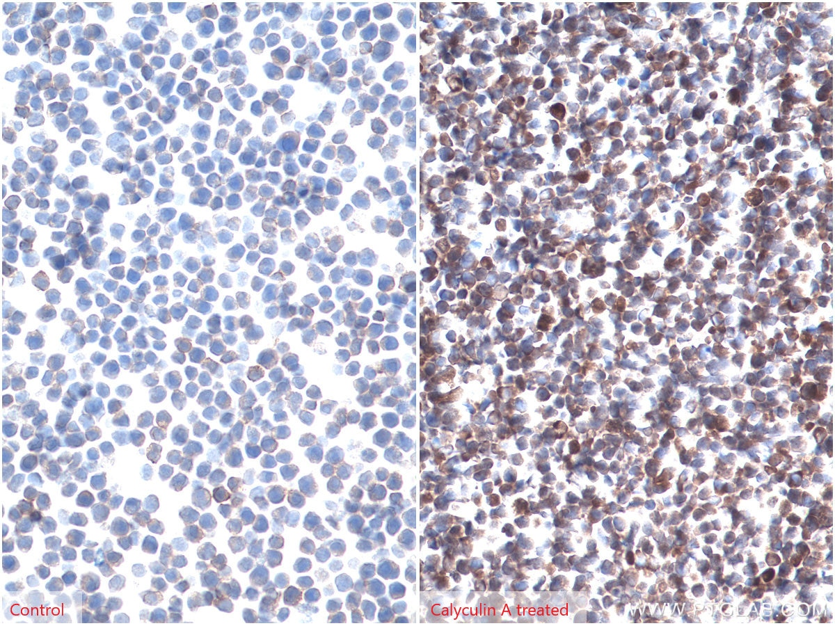 Immunohistochemistry (IHC) staining of Jurkat cells using Phospho-AKT (Ser473) Monoclonal antibody (66444-1-Ig)