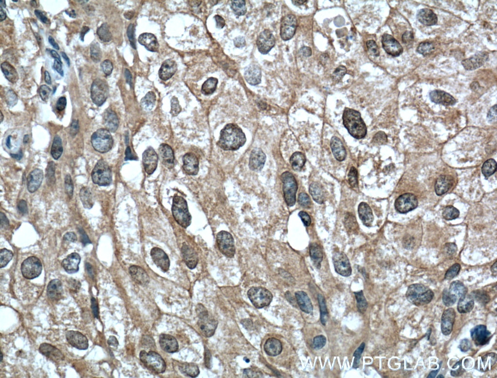 Phospho-AKT (Ser473) Monoclonal antibody