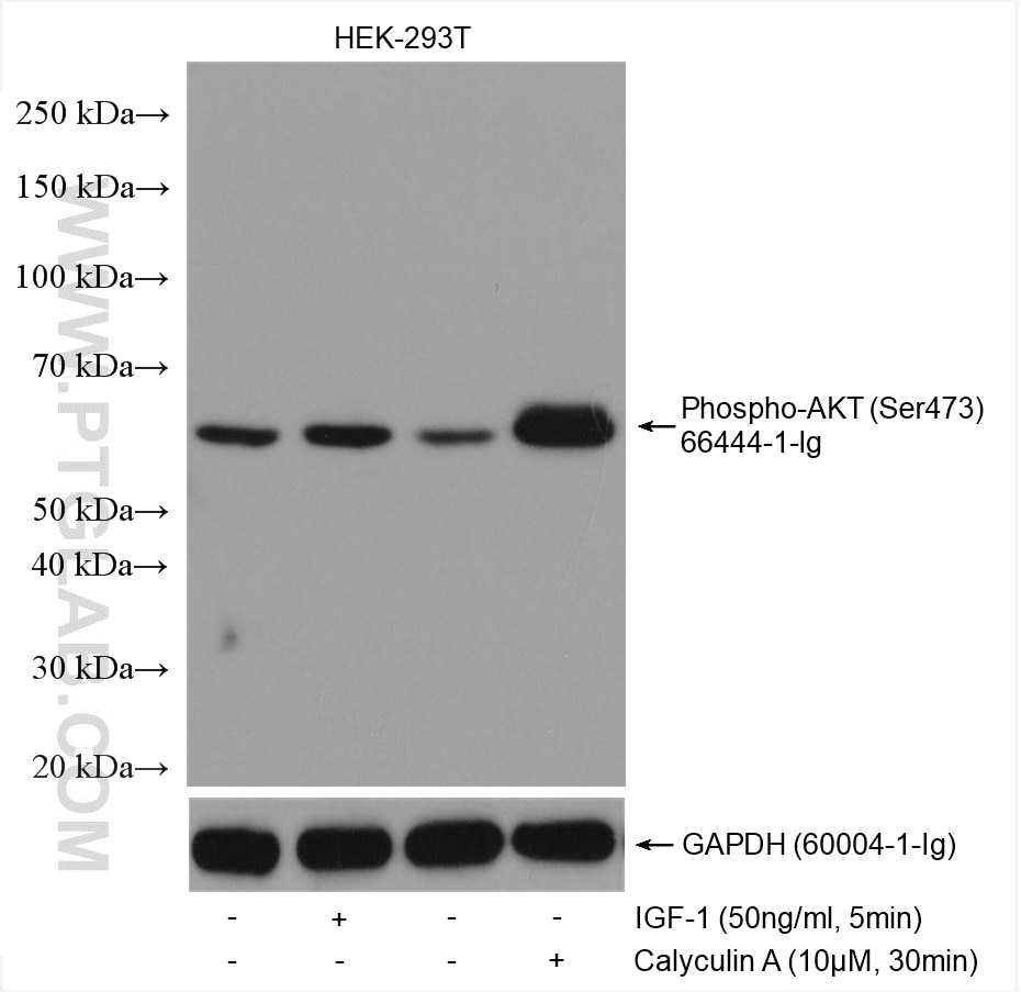 Western Blot (WB) analysis of various lysates using Phospho-AKT (Ser473) Monoclonal antibody (66444-1-Ig)