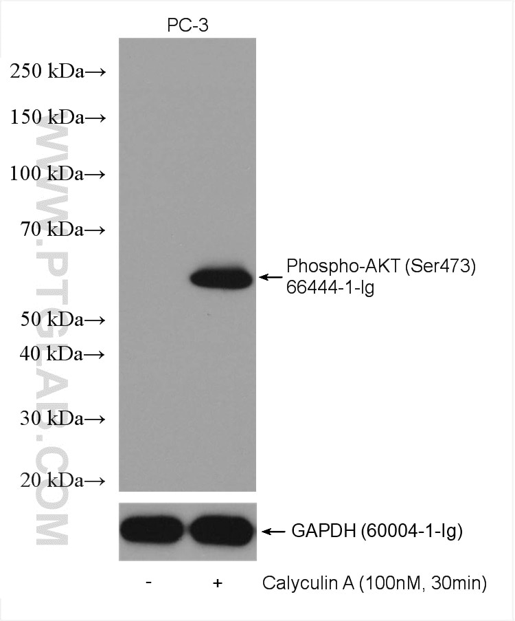 Western Blot (WB) analysis of various lysates using Phospho-AKT (Ser473) Monoclonal antibody (66444-1-Ig)