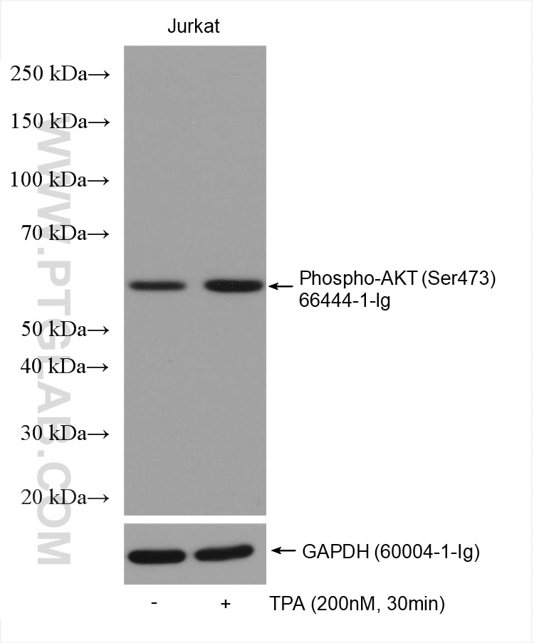 Western Blot (WB) analysis of various lysates using Phospho-AKT (Ser473) Monoclonal antibody (66444-1-Ig)