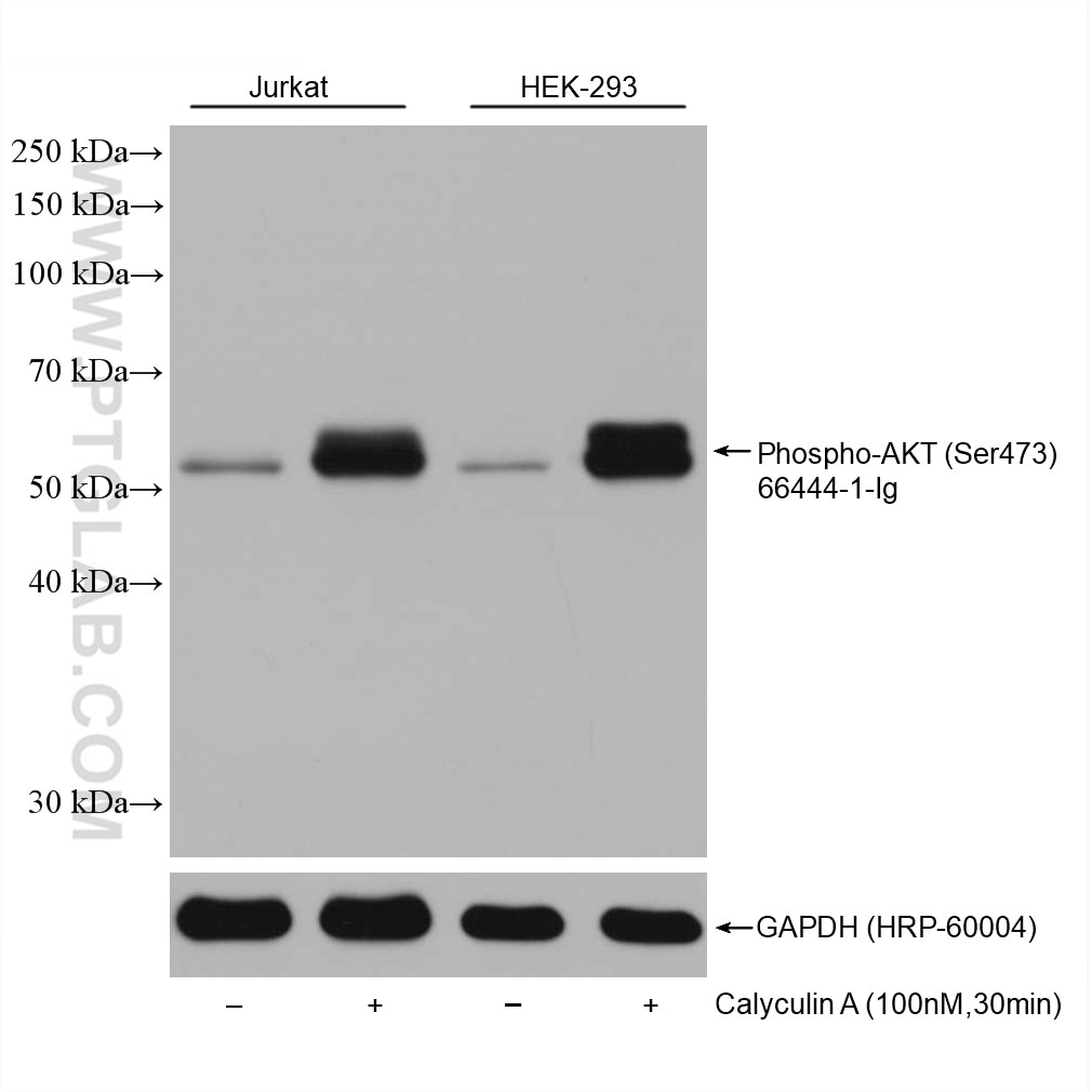 Western Blot (WB) analysis of various lysates using Phospho-AKT (Ser473) Monoclonal antibody (66444-1-Ig)