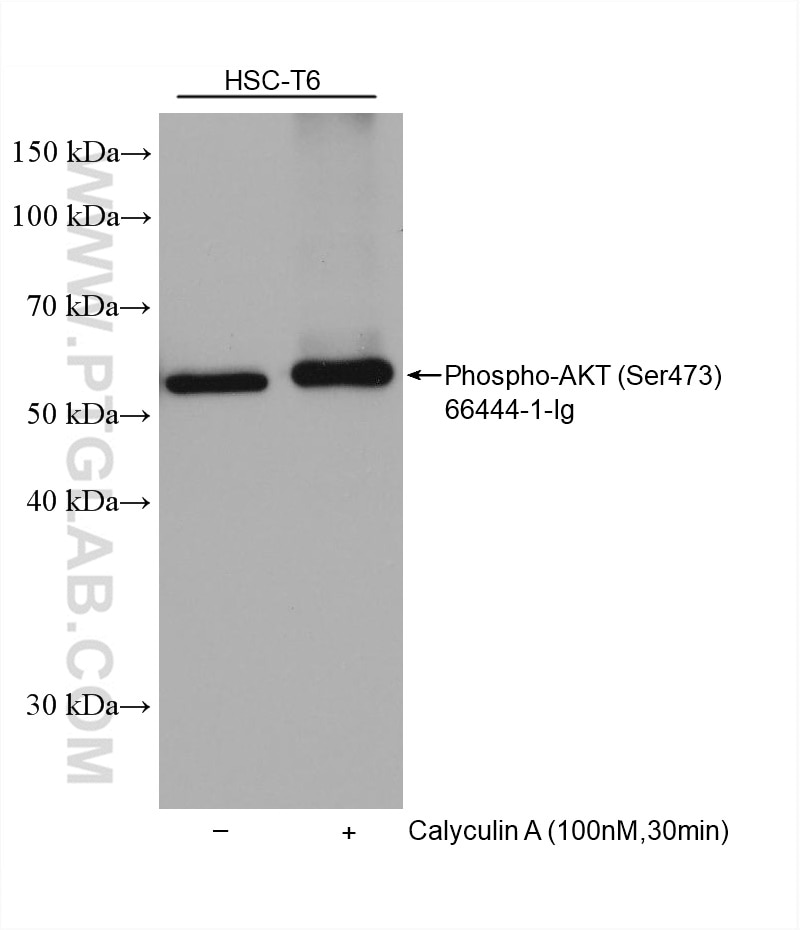 Western Blot (WB) analysis of various lysates using Phospho-AKT (Ser473) Monoclonal antibody (66444-1-Ig)