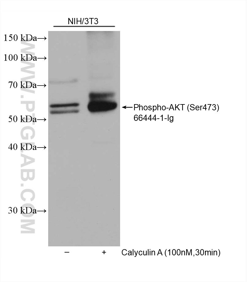 Western Blot (WB) analysis of various lysates using Phospho-AKT (Ser473) Monoclonal antibody (66444-1-Ig)