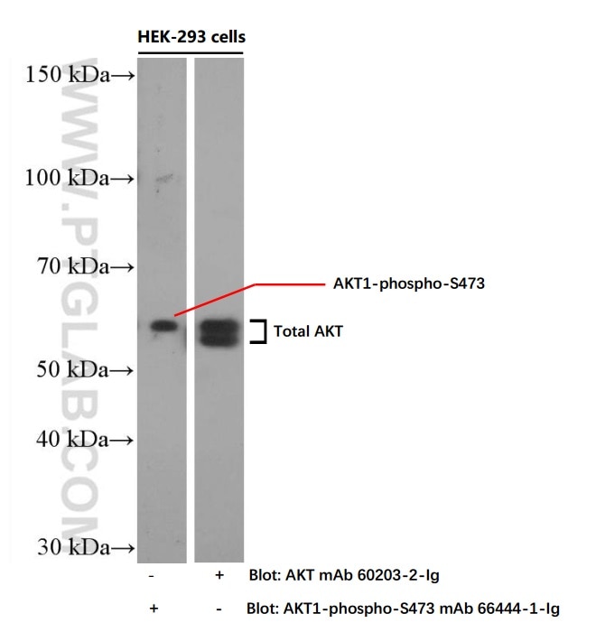 Phospho-AKT (Ser473) Monoclonal antibody