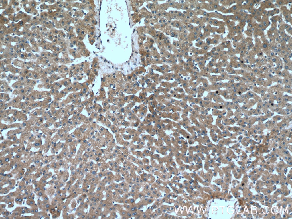 Immunohistochemistry (IHC) staining of human liver tissue using AKT2 Polyclonal antibody (17609-1-AP)