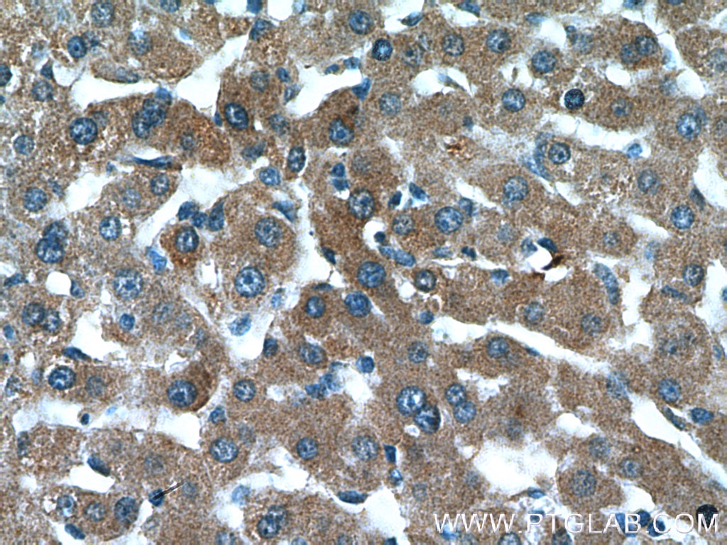Immunohistochemistry (IHC) staining of human liver tissue using AKT2 Polyclonal antibody (17609-1-AP)
