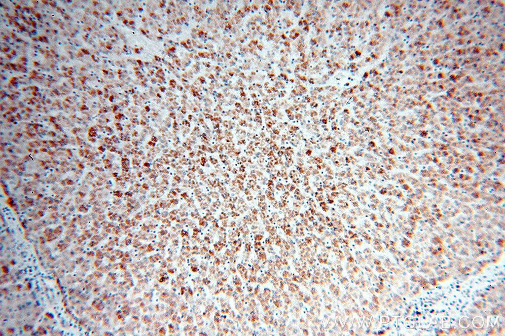 Immunohistochemistry (IHC) staining of human liver tissue using AKT2 Polyclonal antibody (17609-1-AP)