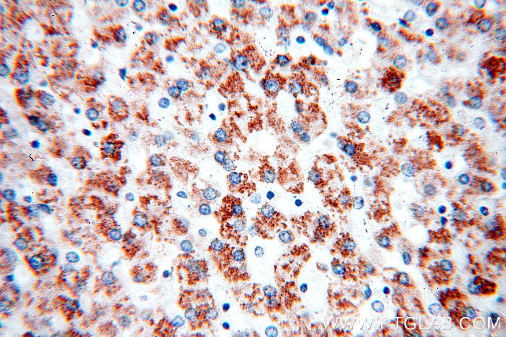 Immunohistochemistry (IHC) staining of human liver tissue using AKT2 Polyclonal antibody (17609-1-AP)