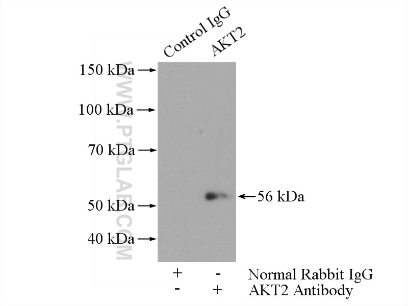 Immunoprecipitation (IP) experiment of HepG2 cells using AKT2 Polyclonal antibody (17609-1-AP)